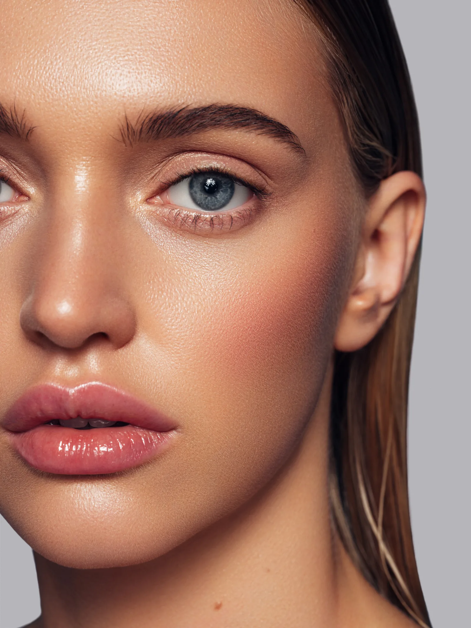 Dermal Fillers in Toronto & the GTA