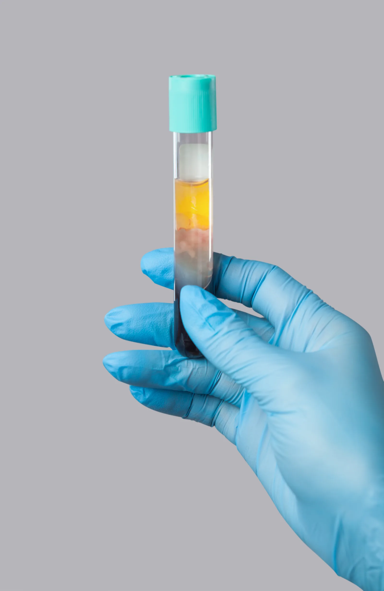 PRP & PRF Treatments